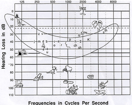 audiology